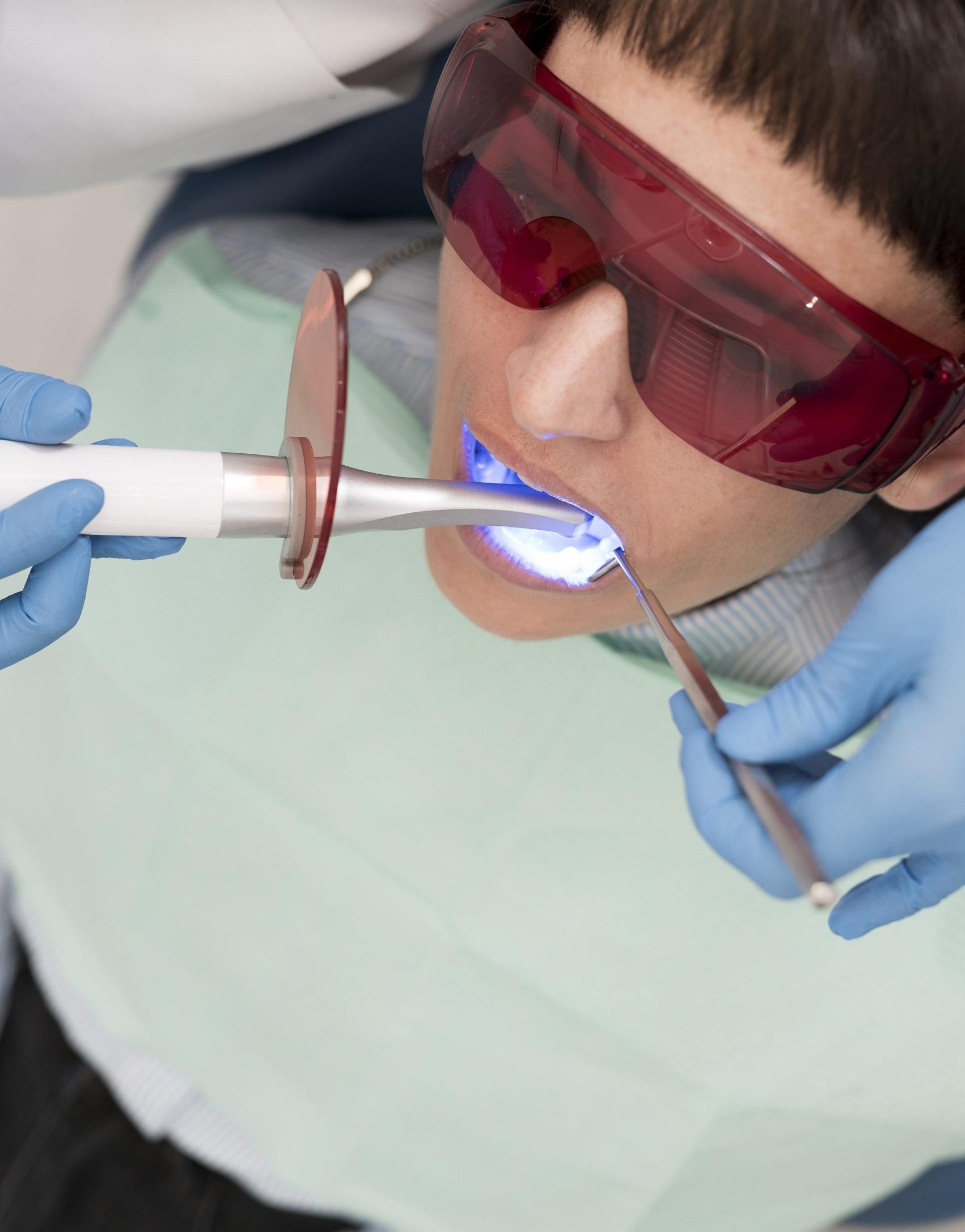 What are the Different Types of Fillings?