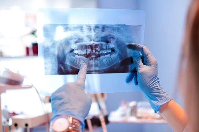 female doctor pointing at teeth x-ray